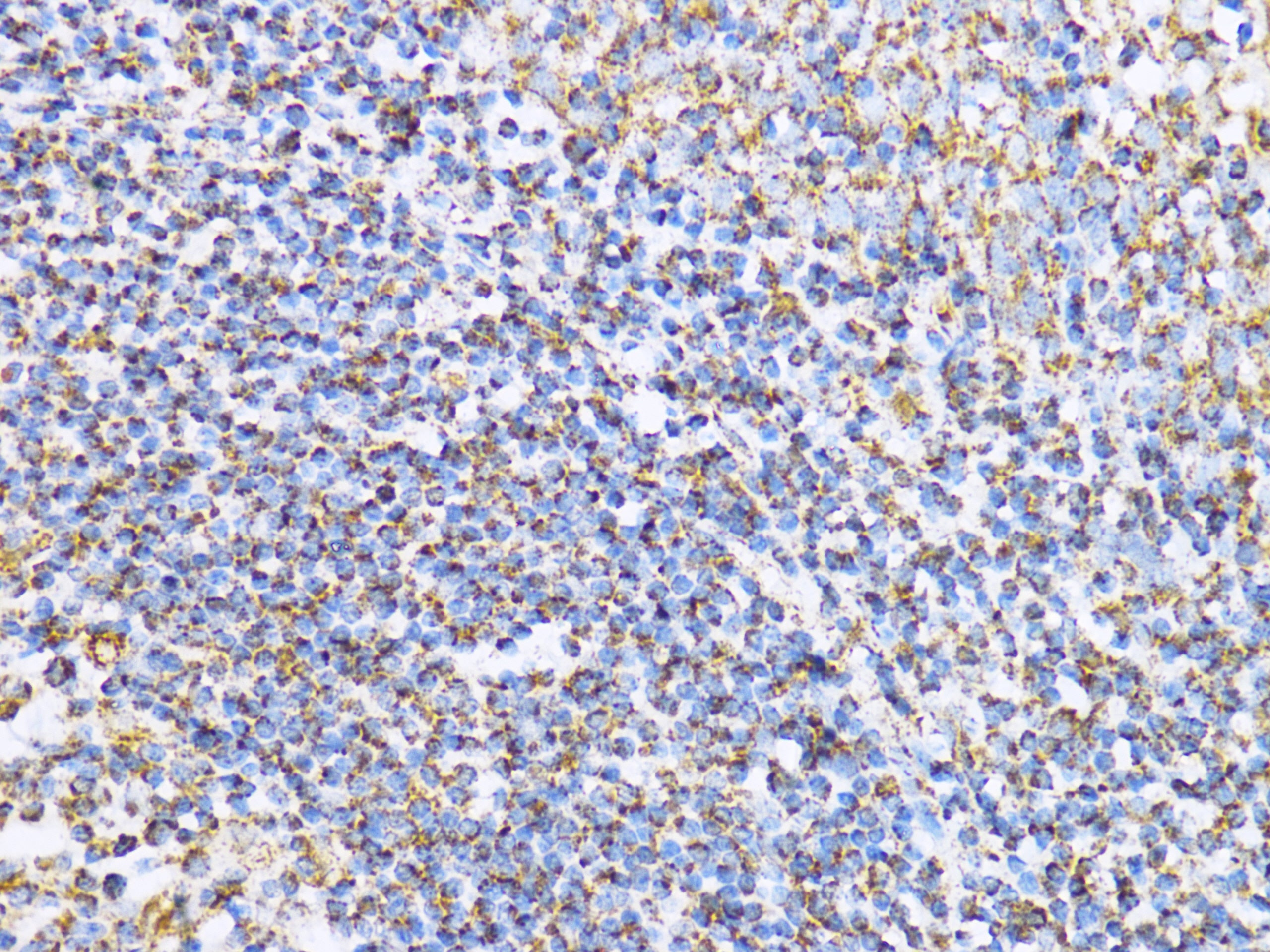 Aconitase 2 (ACO2) Rabbit pAb