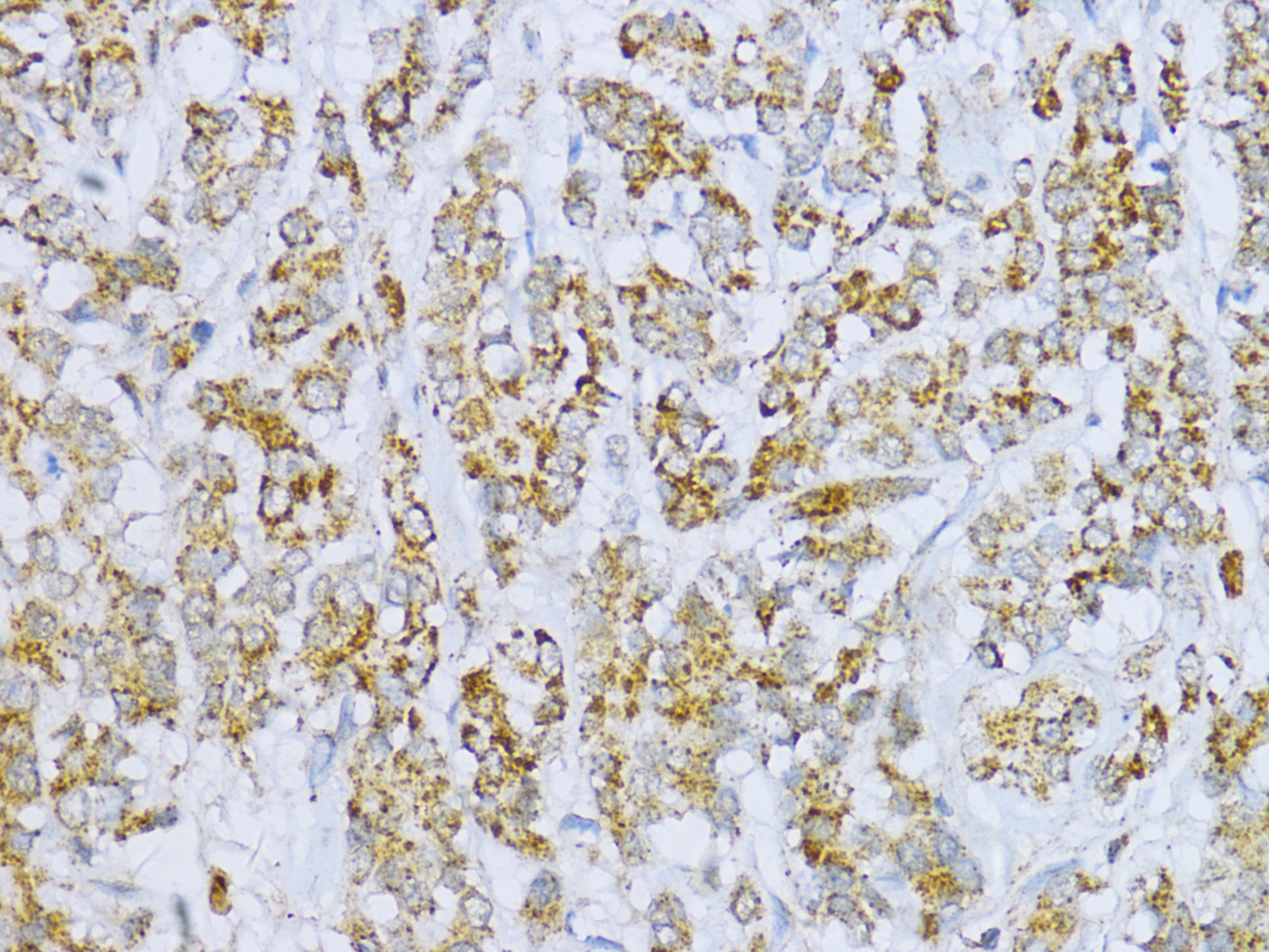 Aconitase 2 (ACO2) Rabbit pAb