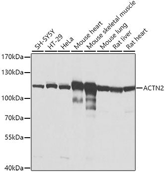 ACTN2 Rabbit pAb