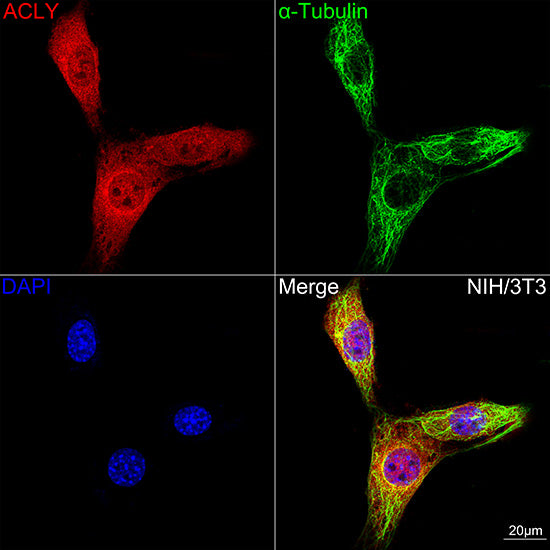 [KO Validated] ACLY Rabbit mAb