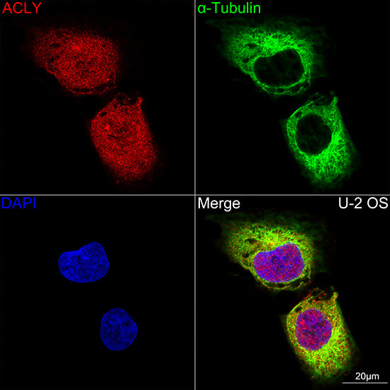 [KO Validated] ACLY Rabbit mAb