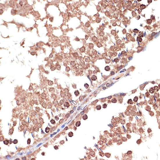 BANF1 Rabbit mAb