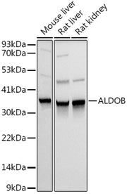 ALDOB Rabbit pAb