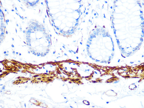 Calponin Rabbit mAb