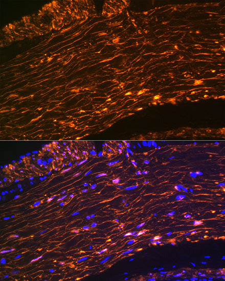 Calponin Rabbit mAb