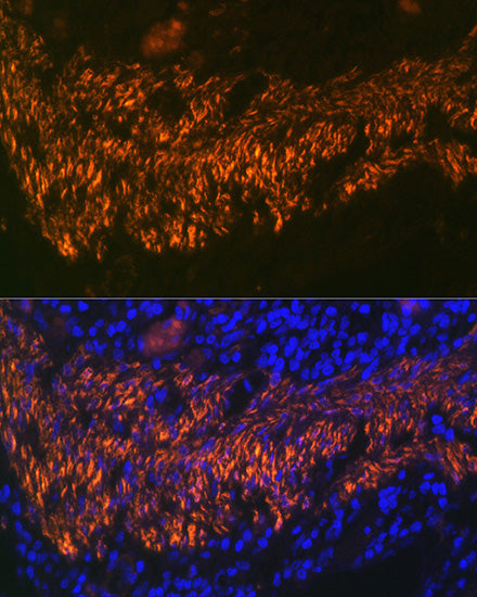 Calponin Rabbit mAb