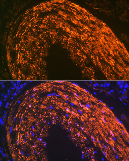 Calponin Rabbit mAb