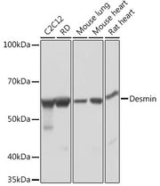 Desmin Rabbit mAb