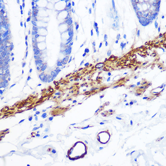 Desmin Rabbit mAb