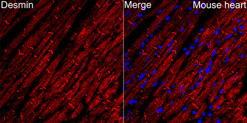 Desmin Rabbit mAb