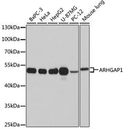 ARHGAP1 Rabbit pAb