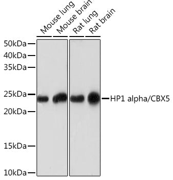 HP1 alpha/CBX5 Rabbit mAb