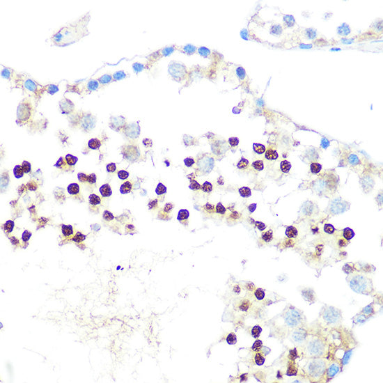 HP1 alpha/CBX5 Rabbit mAb