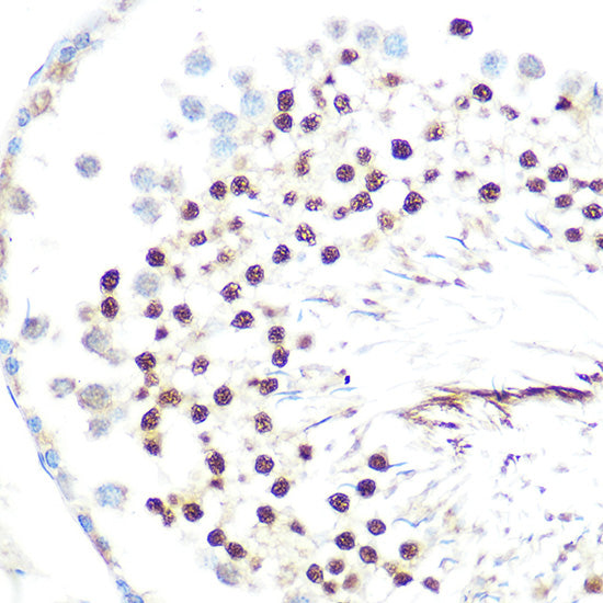 HP1 alpha/CBX5 Rabbit mAb