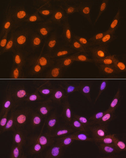 HP1 alpha/CBX5 Rabbit mAb