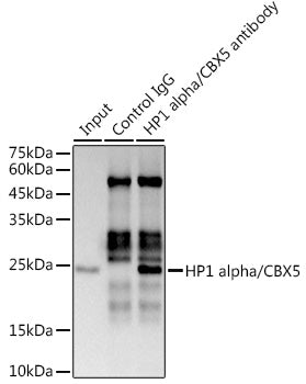 HP1 alpha/CBX5 Rabbit mAb