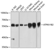 ATP6V1B2 Rabbit pAb