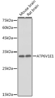 ATP6V1E1 Rabbit pAb