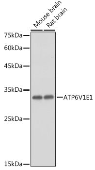 ATP6V1E1 Rabbit pAb