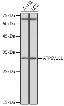 ATP6V1E1 Rabbit pAb