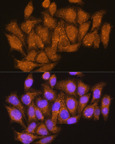 ATP6V1E1 Rabbit pAb