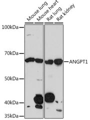 ANGPT1 Rabbit mAb