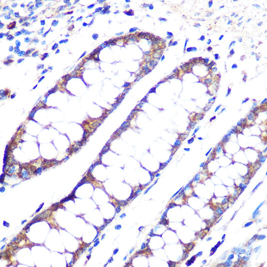 ANGPT1 Rabbit mAb