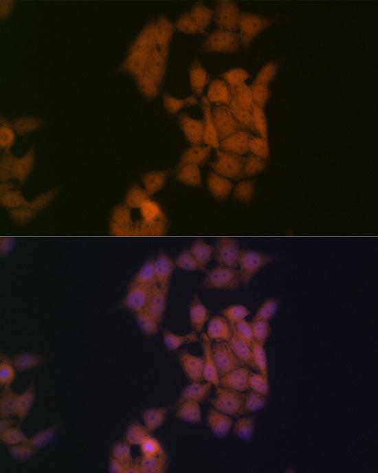 Kaiso/ZBTB33 Rabbit mAb