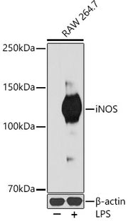 iNOS Rabbit mAb