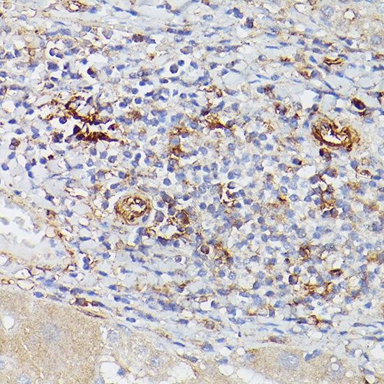 ENTPD1/CD39 Rabbit pAb