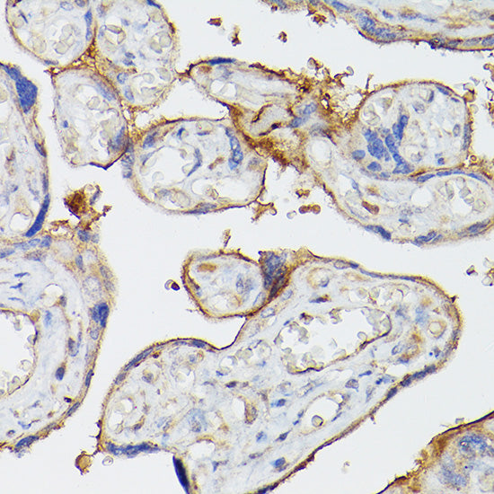 ENTPD1/CD39 Rabbit pAb