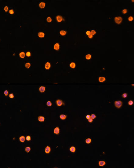 ENTPD1/CD39 Rabbit pAb