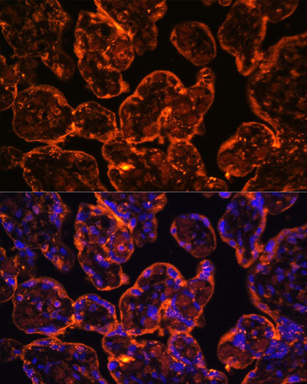 ENTPD1/CD39 Rabbit pAb