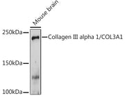 Collagen III alpha 1/COL3A1 Rabbit pAb