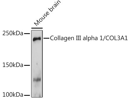 Collagen III alpha 1/COL3A1 Rabbit pAb