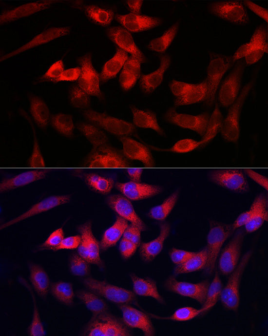 Collagen III alpha 1/COL3A1 Rabbit pAb