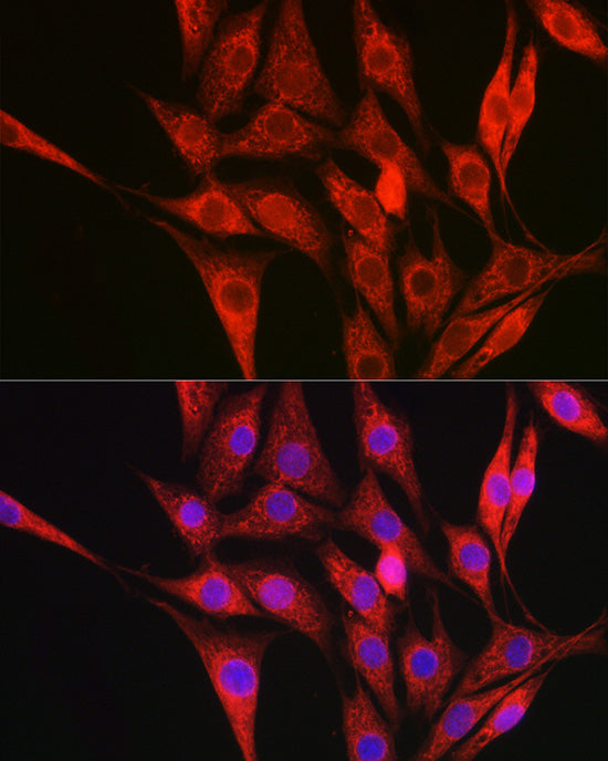 Collagen III alpha 1/COL3A1 Rabbit pAb