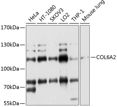 COL6A2 Rabbit pAb