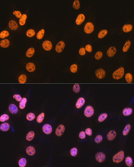 NONO/p54nrb Rabbit mAb