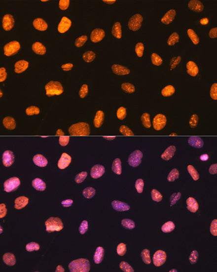 NONO/p54nrb Rabbit mAb