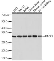 RACK1 Rabbit mAb