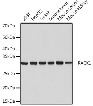 RACK1 Rabbit mAb