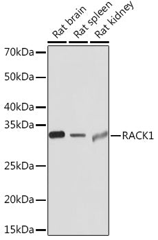RACK1 Rabbit mAb