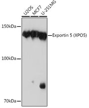 Exportin 5 (XPO5) Rabbit mAb