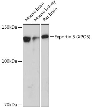 Exportin 5 (XPO5) Rabbit mAb