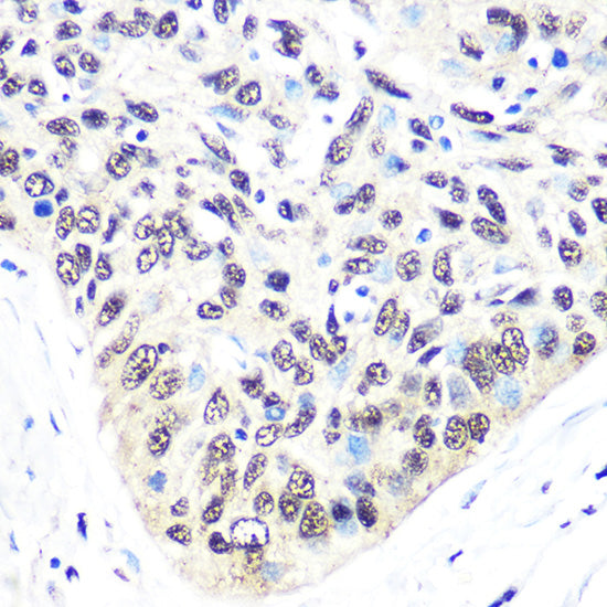 Exportin 5 (XPO5) Rabbit mAb