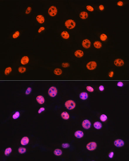 BAF57/SMARCE1 Rabbit mAb