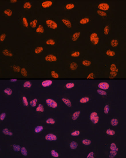 BAF57/SMARCE1 Rabbit mAb
