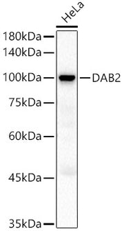 DAB2 Rabbit pAb