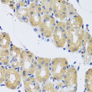 DYNC1I1 Rabbit pAb